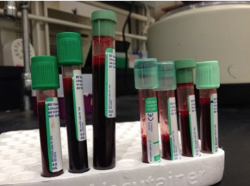vials of blood image
