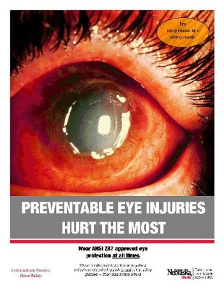 Eye Injuries